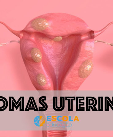 Tumores Uterinos Tudo Sobre Tumores Uterinos Escola Educa O