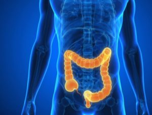 Doença de Crohn Intestino