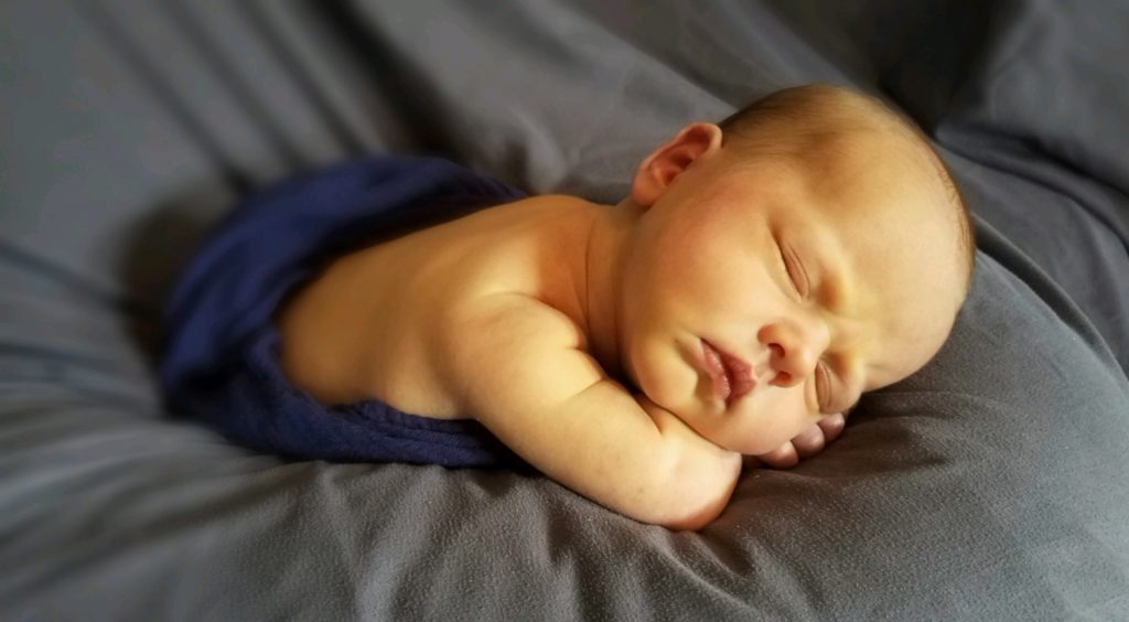 Icterícia Neonatal ou Icterícia do recém-nascido