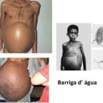 barriga de água