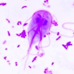 Protozoários – Giardia lamblia