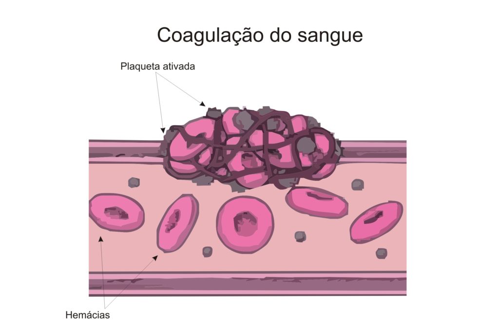 Plaquetas - Coagulação sanguínea