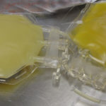 Plasma sanguíneo