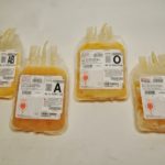 Plasma sanguíneo – Tipos de plasma
