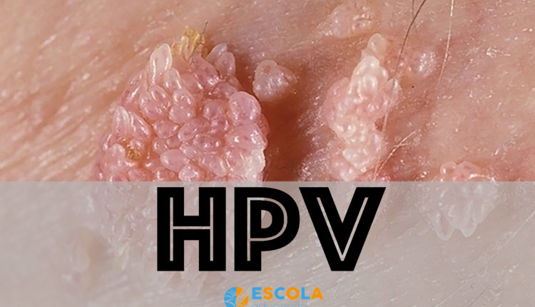 HPV - Vírus do Papiloma Humano