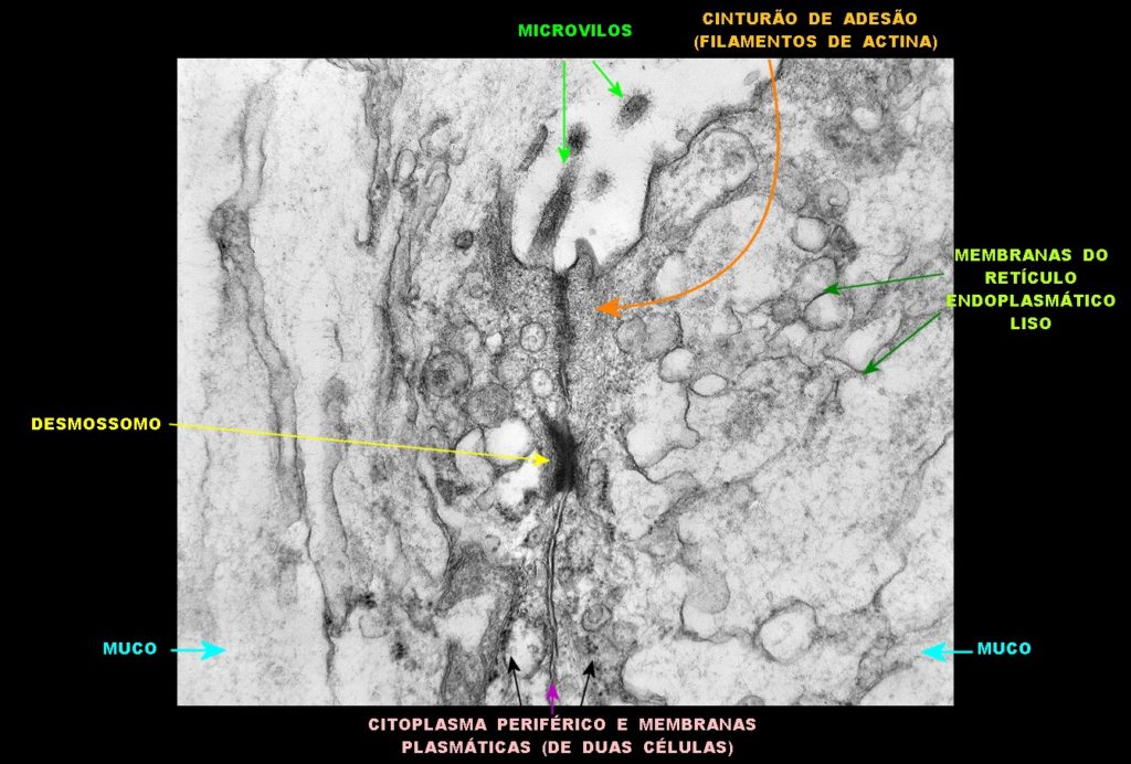 Desmossomos (Imagem retirada do Site didático de Anatomia Patológica, Neuropatologia e Neuroimagem da UNICAMP)