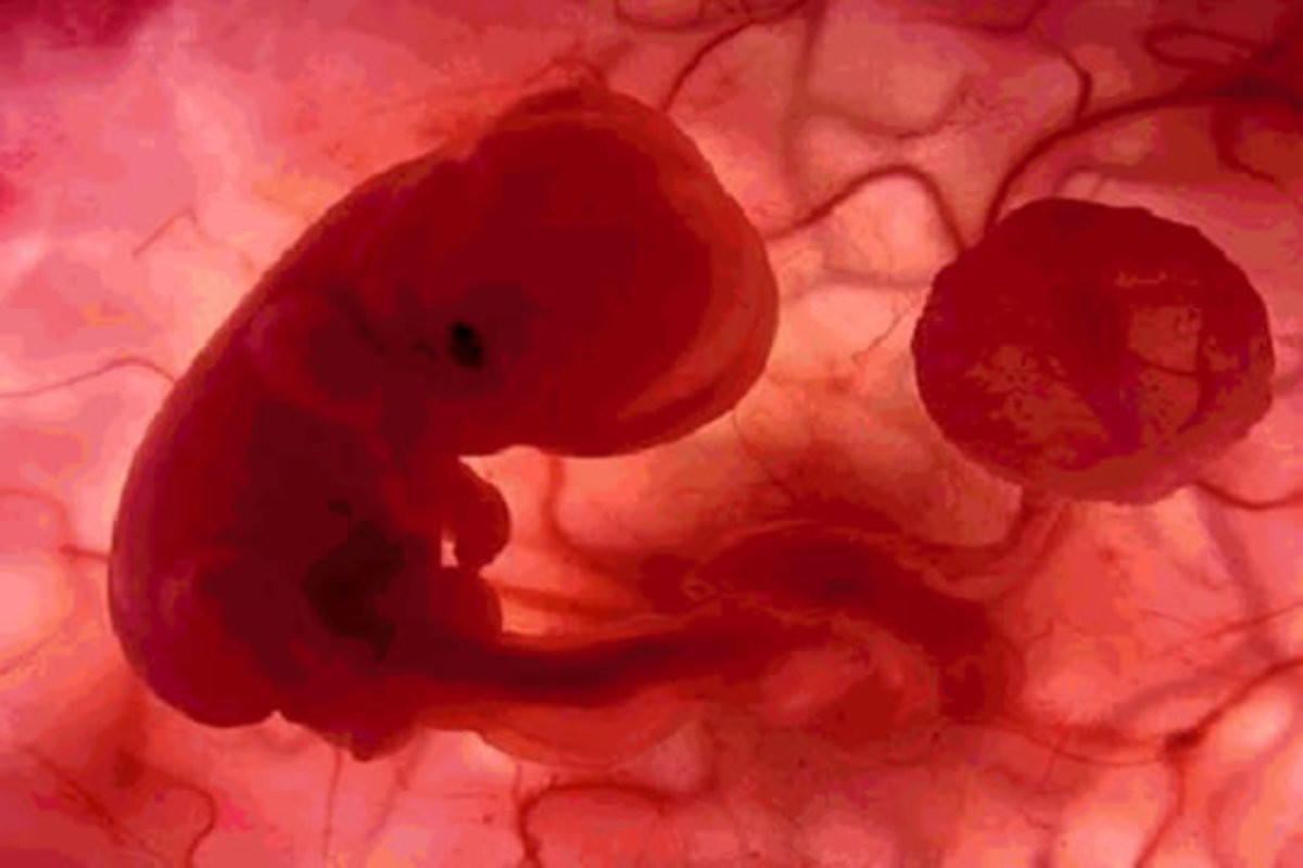 Anexos embrionários - Embrião