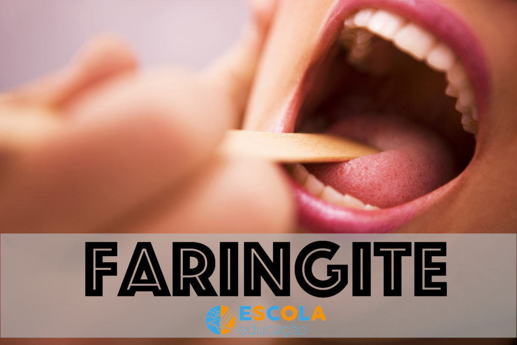 Faringite
