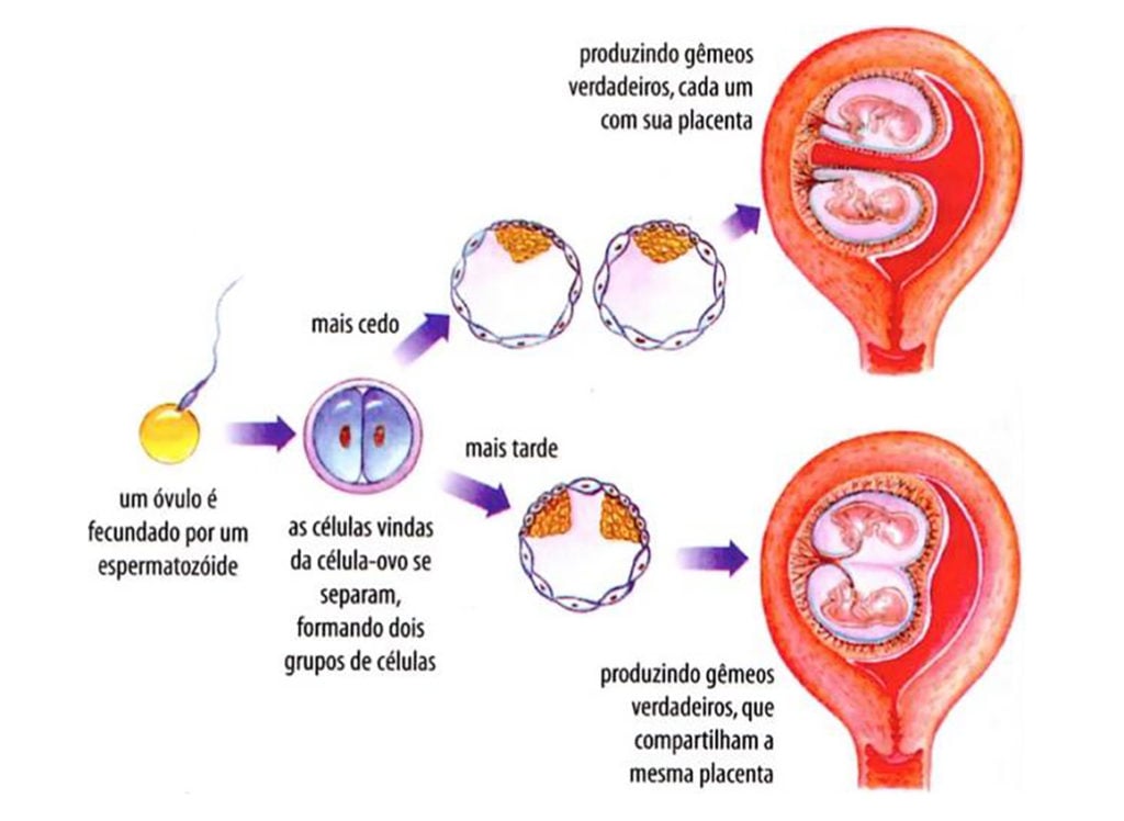 Fecundação humana - Desenvolvimento embrionário humano - Gravidez múltipla