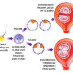 Fecundação humana – Desenvolvimento embrionário humano – Gravidez múltipla