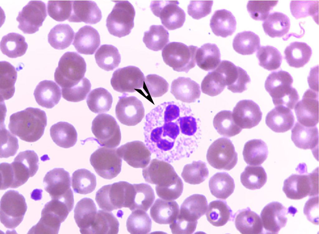 Neutrófilo (seta preta) com núcleo segmentado. (Foto retirada do site do Laboratório de Análises Clínicas e Ensino em Saúde - LACEN - da UFG).