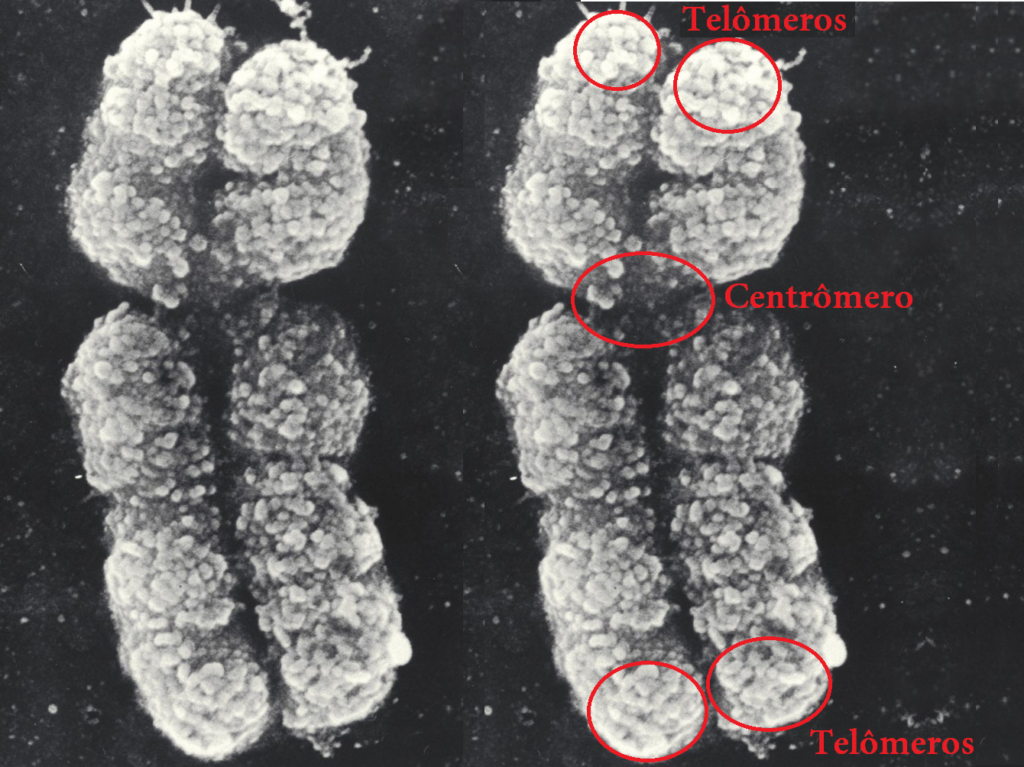Cromossomos - Partes do cromossomo