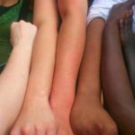 Pele humana