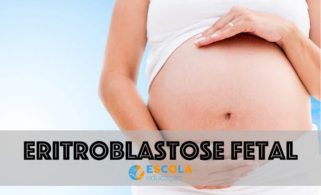 Eritroblastose fetal