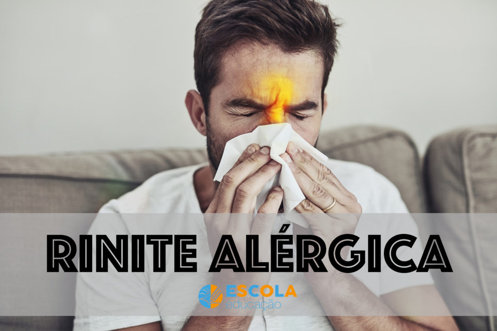 Rinite alérgica