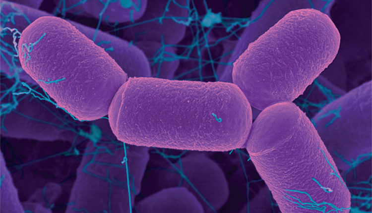 O que é Archaea? - Características do reino, domínio, procariontes