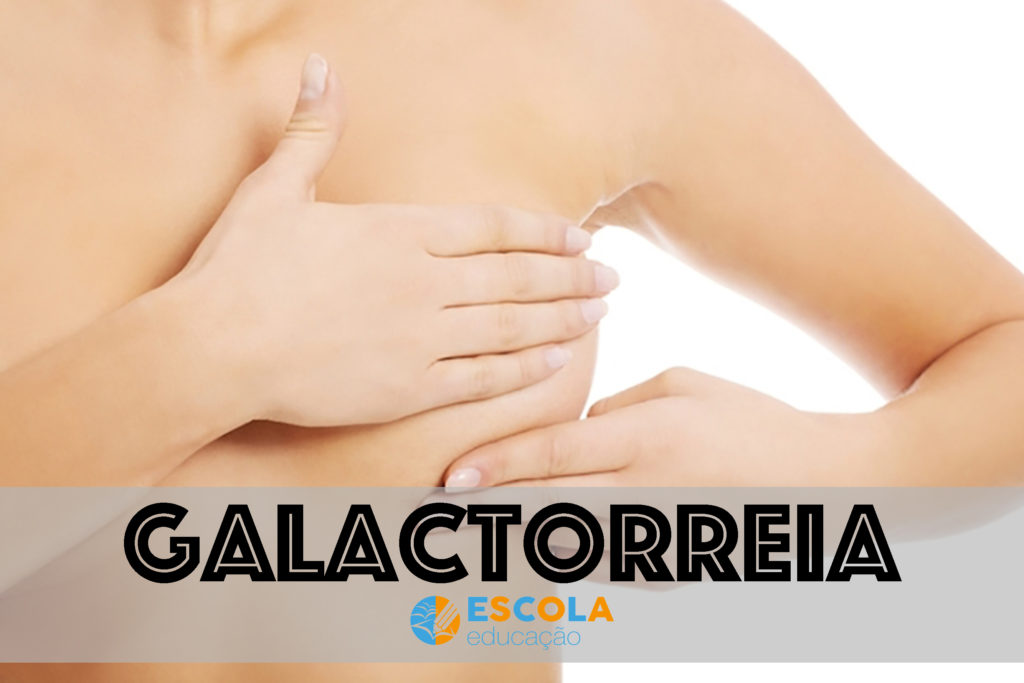 Galactorreia