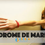 Síndrome de Marfan