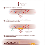 Hemofilia – Coagulação sanguínea