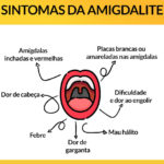 Sintomas da amigdalite