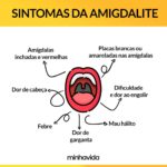 Sintomas da amigdalite