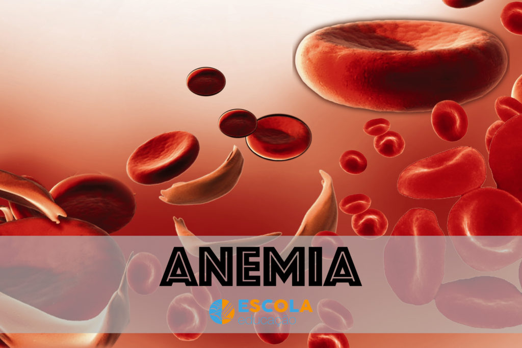 Anemia