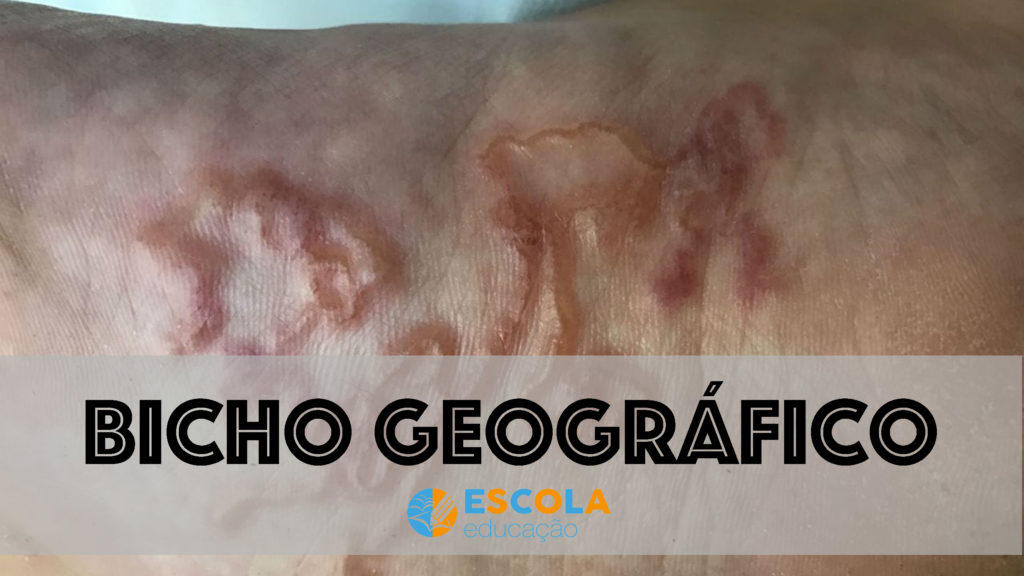 Bicho geográfico