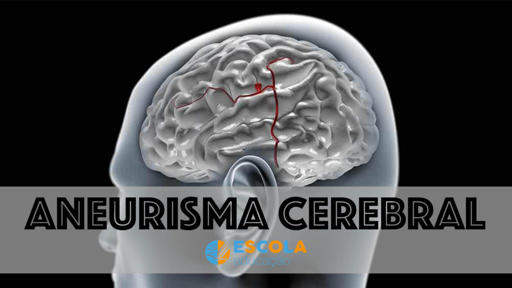 Aneurisma cerebral