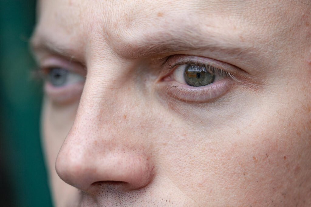 Olhos tremendo