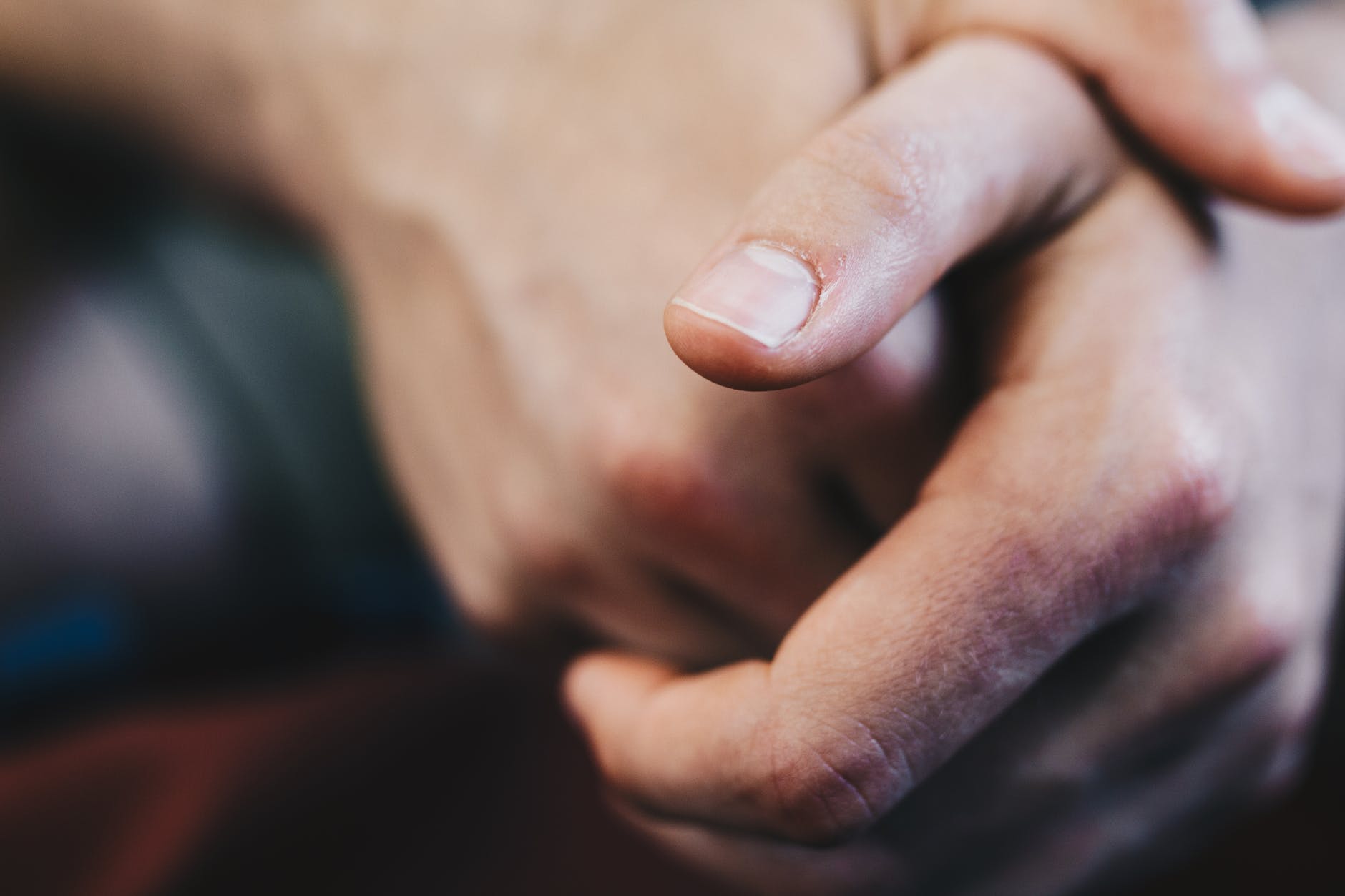 Suas unhas podem estar avisando algo sobre sua saúde – veja os sinais!