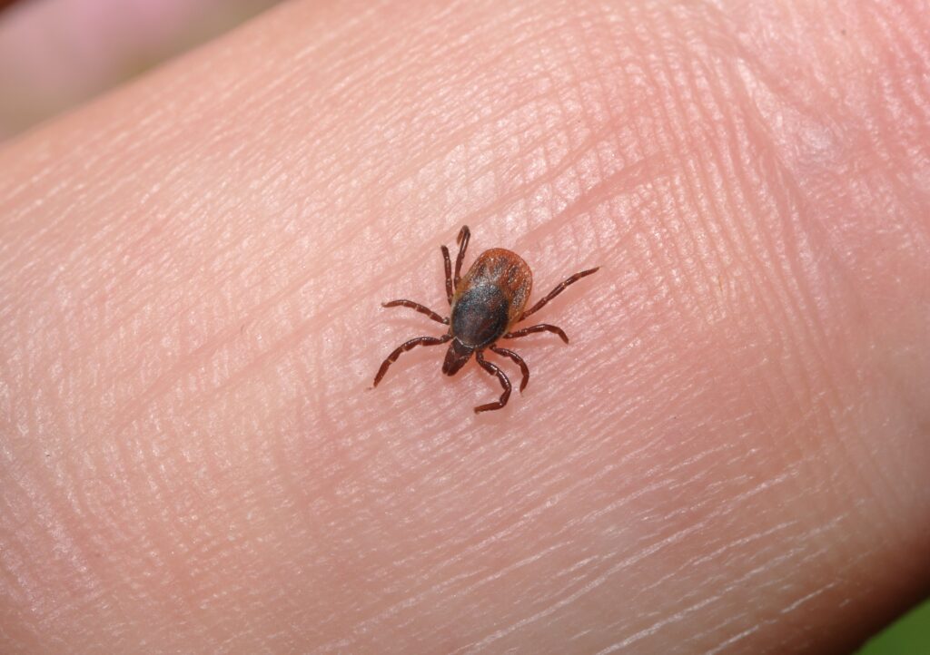 Entenda como os piolhos ajudaram cientista a compreender a evolução humana (19/04)