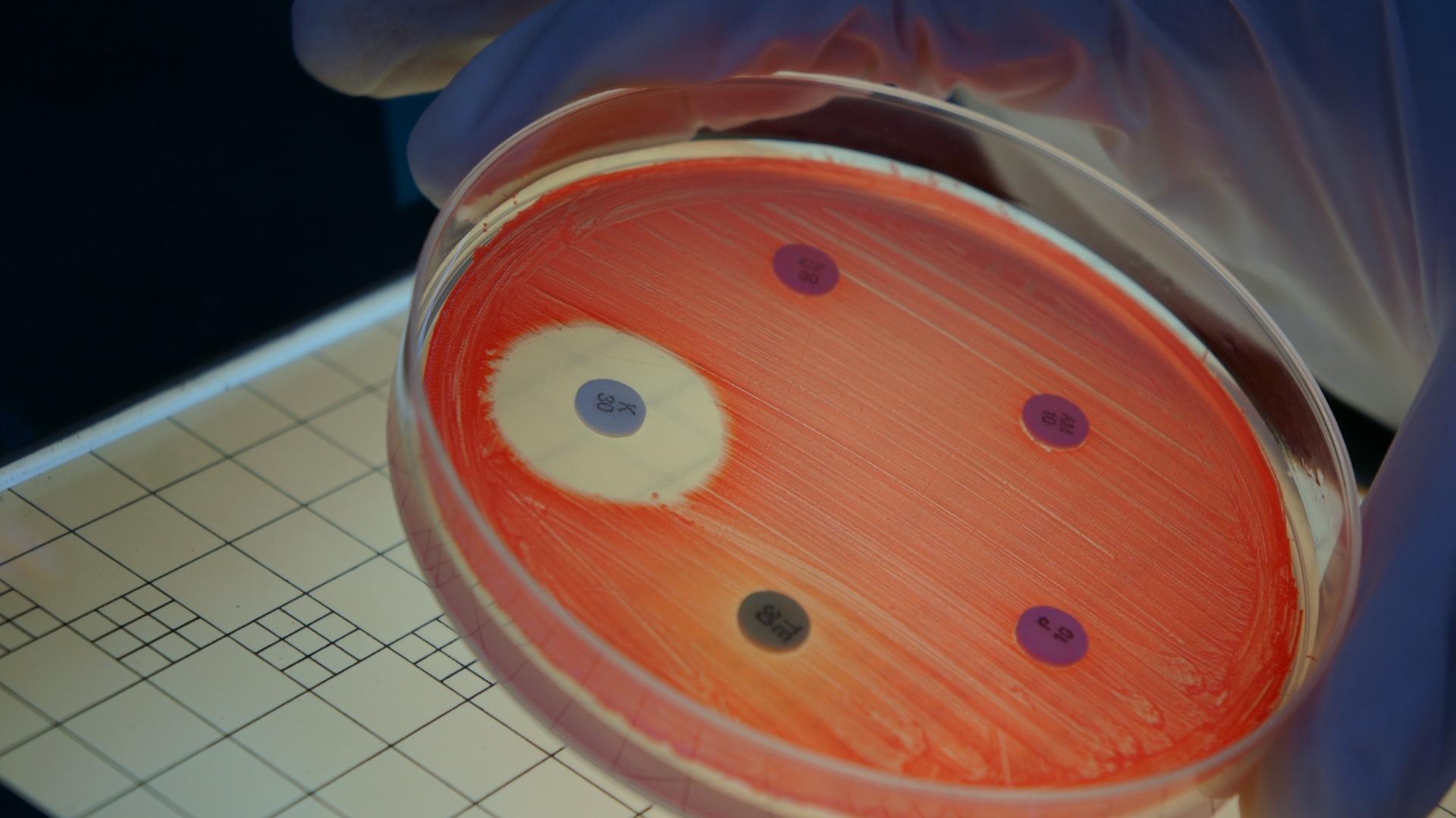 Bactéria resistente a drogas, Foto: Canva.