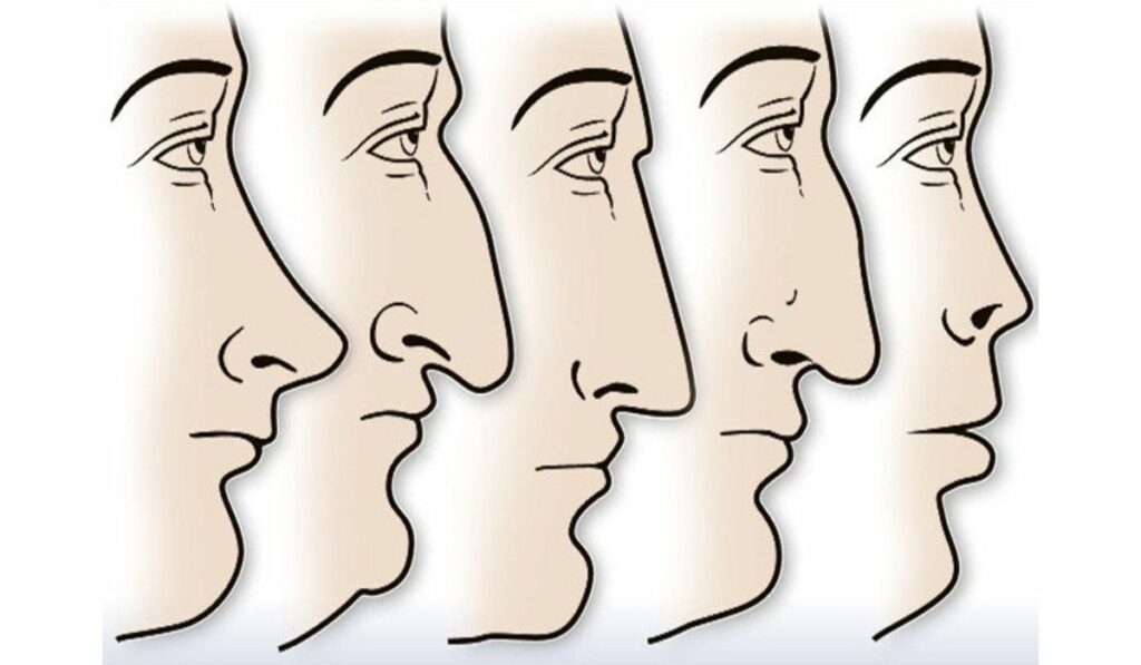 Traços do seu nariz têm relação direta com seus aspectos de personalidade