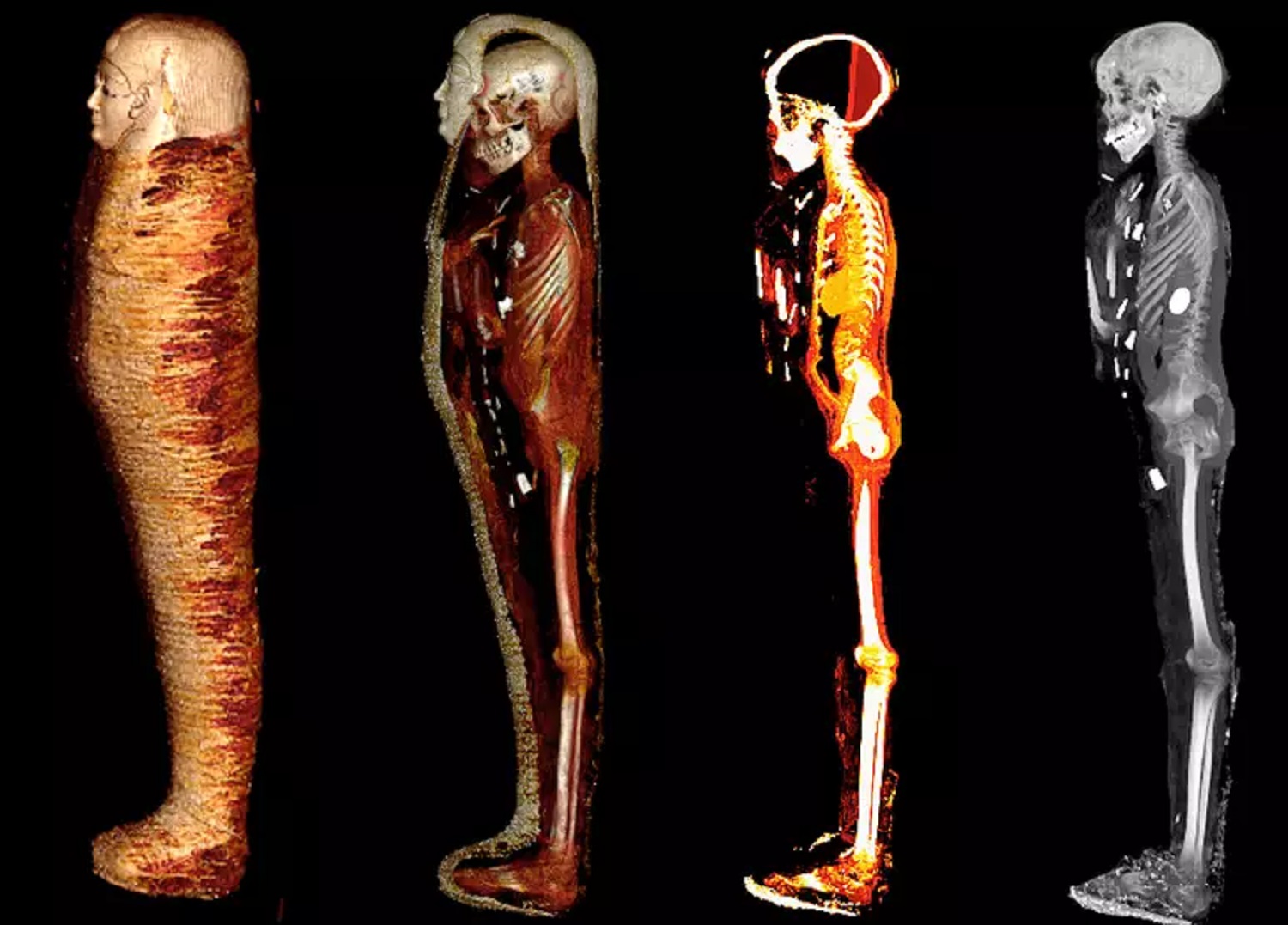 Múmia com 'coração' de ouro: entenda este artefato enigmático do Antigo Egito