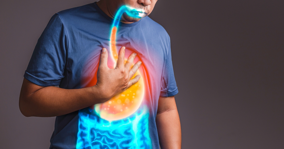 Quer evitar refluxo e gastrite? Então fique longe desses hábitos logo após as refeições