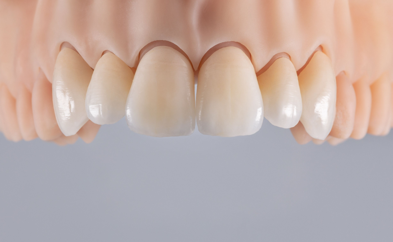 Cientistas criam remédio que faz os dentes crescerem