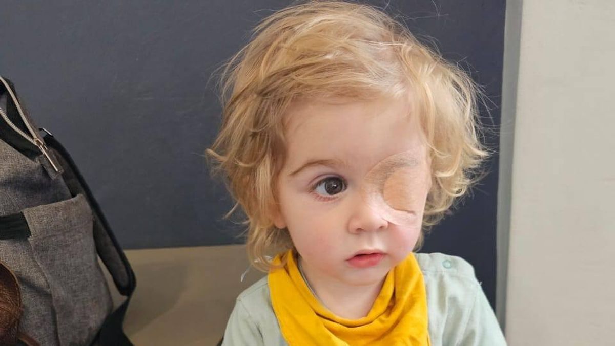 Herpes labial pode cegar! Caso de menino de 2 anos acende ALERTA para pais